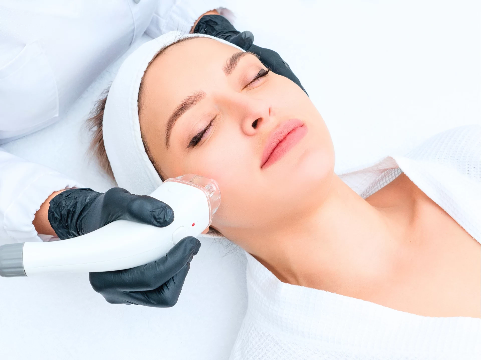 Ryppyjen poistolaserilla