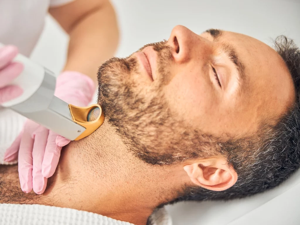 Laserkarvanpoisto miehille